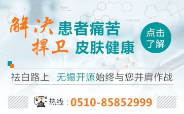 苏州白斑病的专科医院分析如何进行白癜风的初期诊断